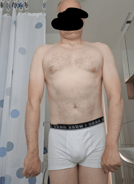Transformation von Bernhard G. – Ansicht 2